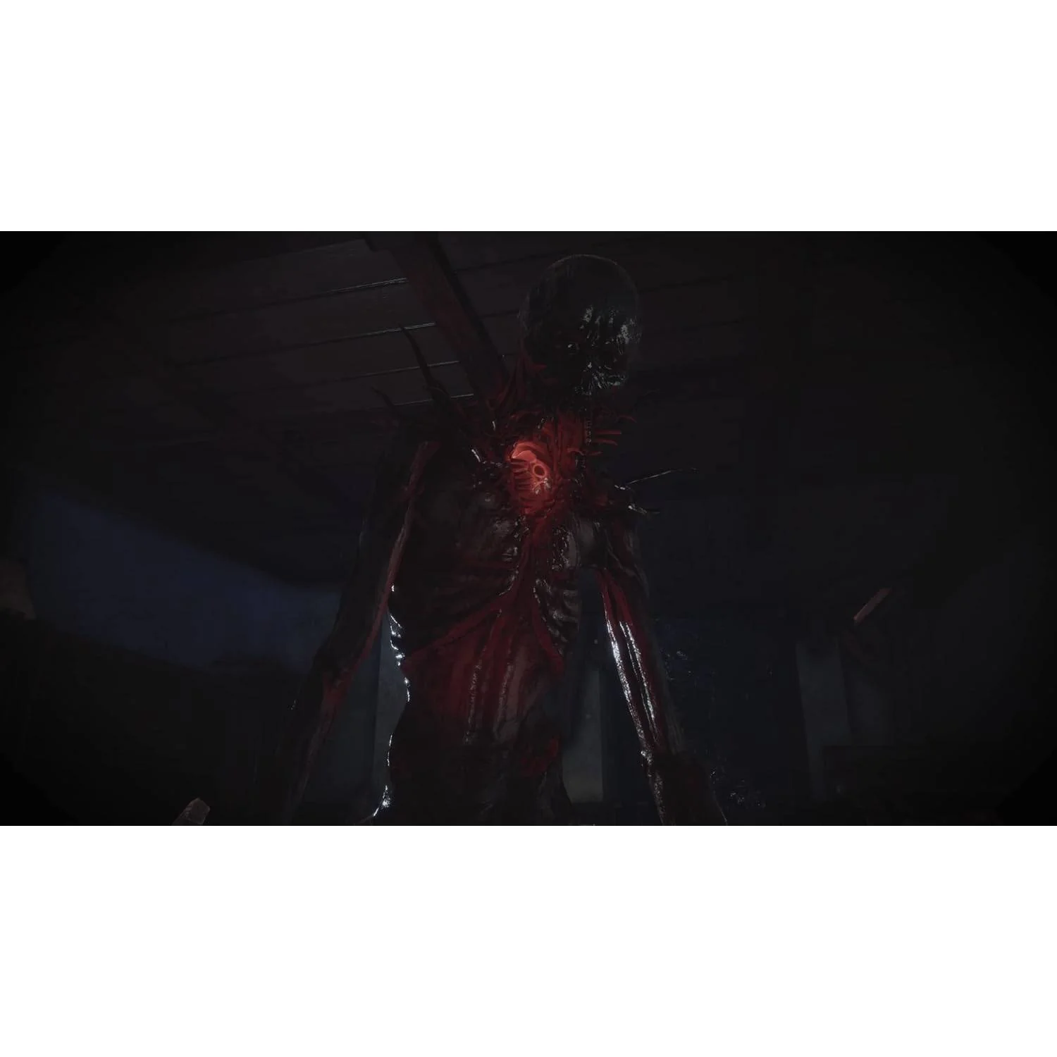 Fobia: St. Dinfna Hotel - Xbox Series X, Xbox One - Maximum Games - Image 5